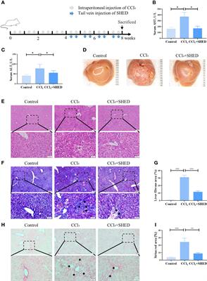 Stem Cells From Human Exfoliated Deciduous Teeth Alleviate Liver Cirrhosis via Inhibition of Gasdermin D-Executed Hepatocyte Pyroptosis